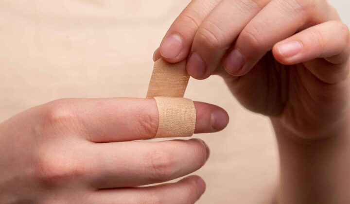 Comment réagir en cas de brûlure ? Conseils de premiers secours